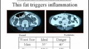 Lose Weight and Control Prediabetes with the Unique Power of PGX