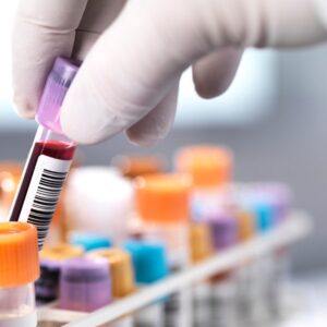 A gloved hand holds a test tube of blood in a clinical lab setting with colorful test tubes in the background, focusing on medical diagnostics and testing.